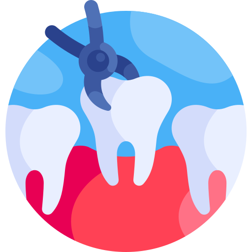 Tooth Extraction